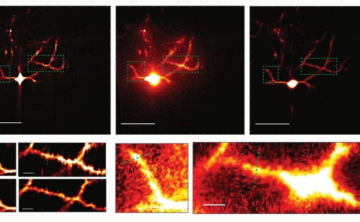 A neuron imaged with multiline orthogonal scanning temporal focusing (mosTF). Right: The same neuron imaged with line-scanning temporal focusing microscope (lineTF). Below are magnifications of the dotted areas. In the mosTF images dendritic spines are clearly visible in the magnified images, while they are obscured by noise in the lineTF image.