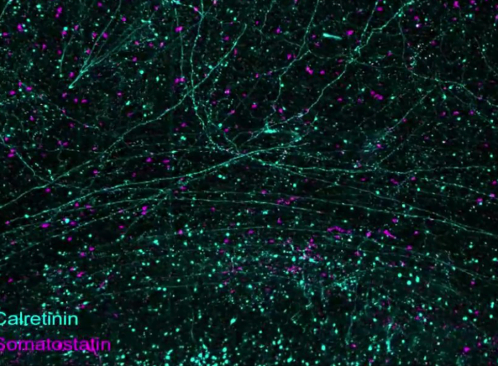 An MIT-led team has developed a series of technologies to image and analyze the brain at scales ranging from a whole brain hemisphere down to individual neural connections and proteins. In this still frame from a video (see below), two kinds of neurons (calretinin-expressing in cyan and somatostatin-expressing in magenta) are visible in the prefrontal cortex of a human brain.